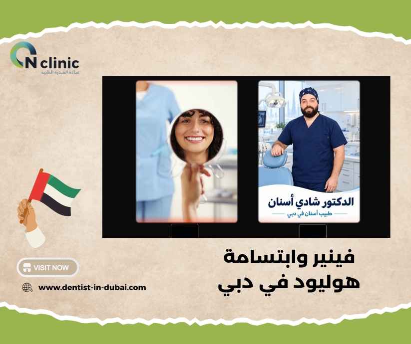 فينير وابتسامة هوليود في دبي