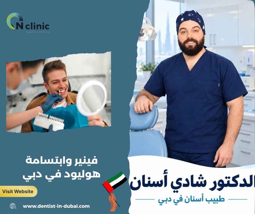 فينير وابتسامة هوليود في دبي