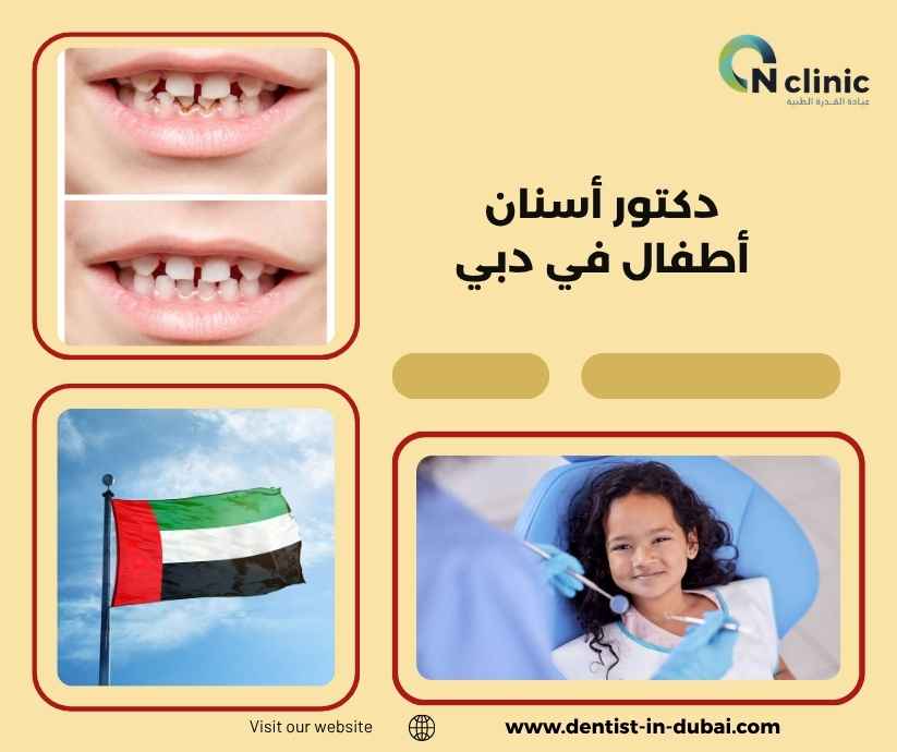 دكتور أسنان أطفال في دبي