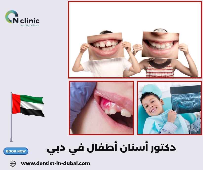 دكتور أسنان أطفال في دبي